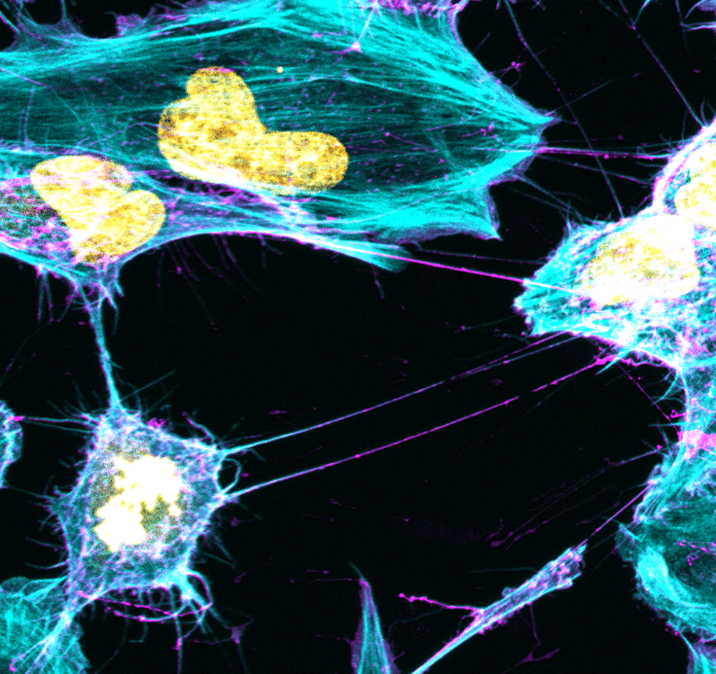 Microglial cells (in cyan and magenta) connected by tunneling Nanotubes (TNTs). Nuclei are depicted in yellow.