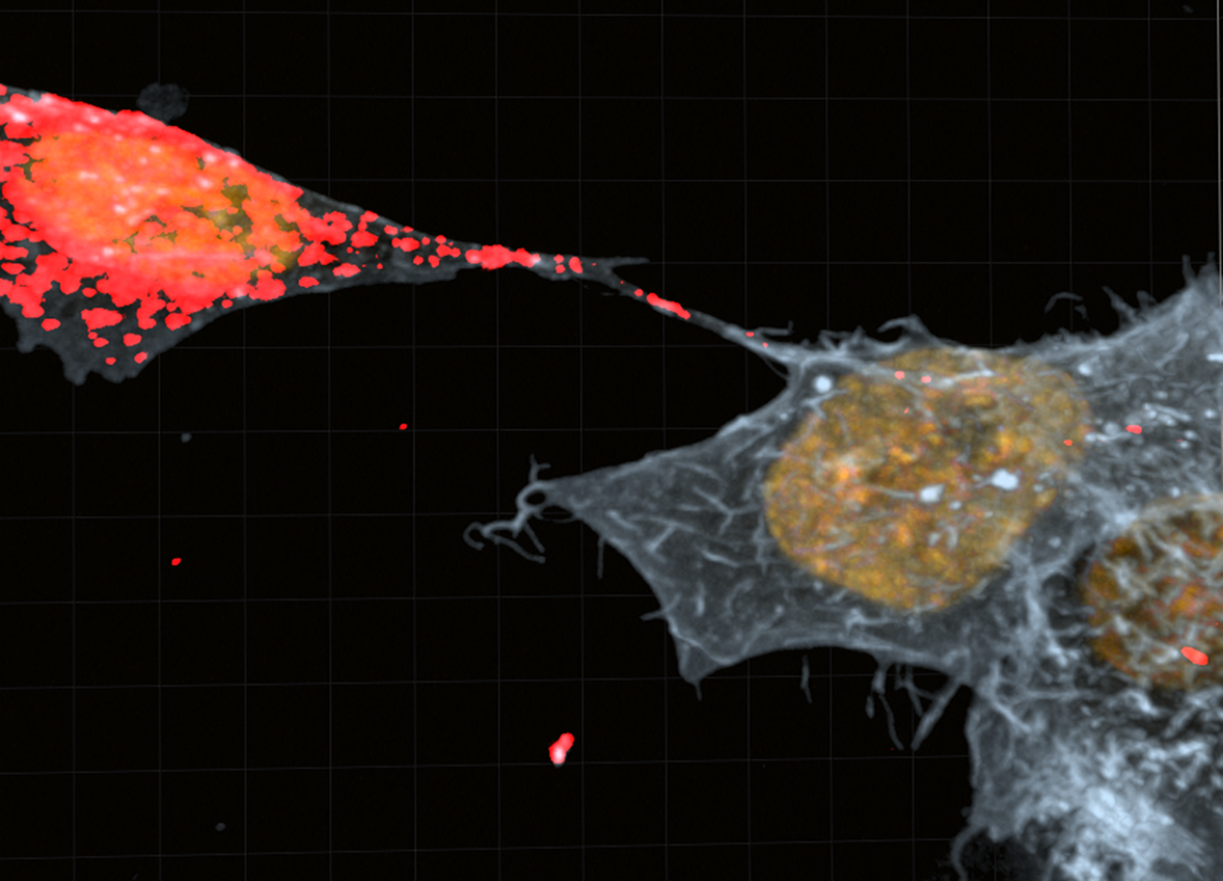 Transfer of 𝛼-Synuclein aggregates (in red) from neuronal cells (left) to microglial cells (right) via Tunneling Nanotubes (TNTs)