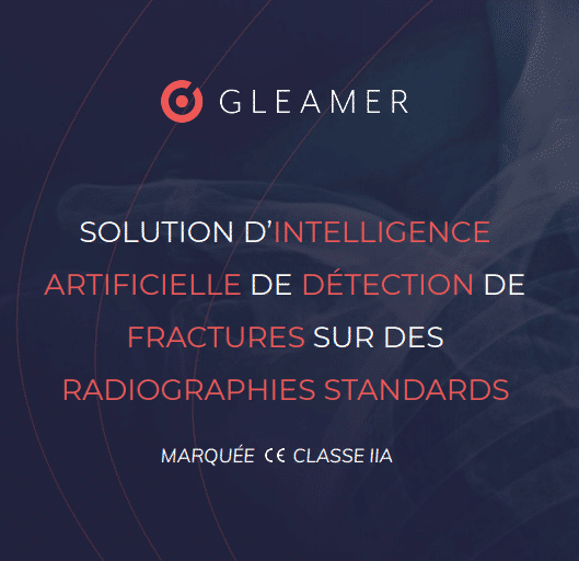Gleamer